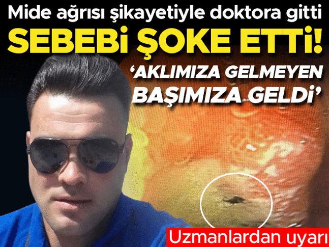 Mide ağrısı şikayetiyle doktora gitti, hayatının şokunu yaşadı!
