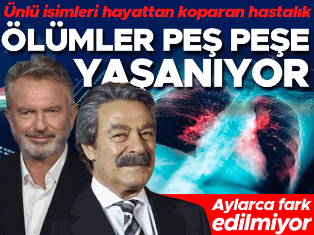 Ölümler peş peşe yaşanıyor... Ünlü isimleri hayattan koparan hastalık! Aylarca fark edilmiyor, üstelik her yaş grubu risk altında