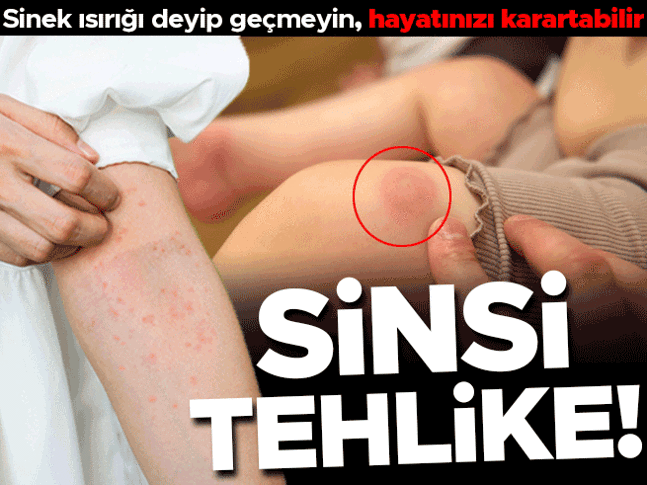 Sinsi tehlike! Böcek ısırığı deyip geçmeyin... Hayatınızı karartabilecek bir hastalığı tetikleyebilir