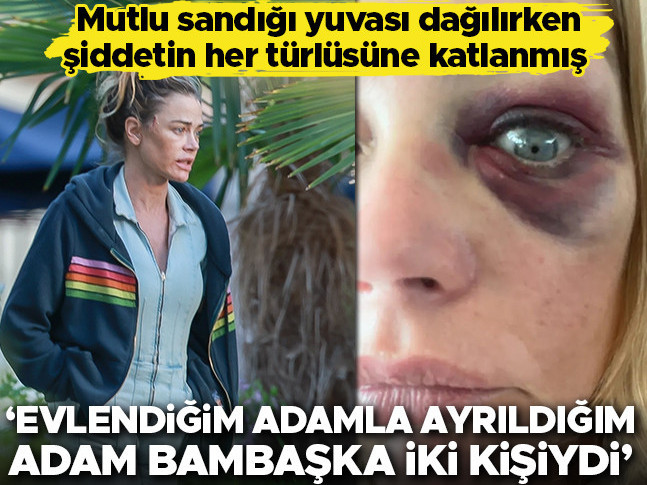 Mutlulukla kurduğu yuvayı eşinden şiddet gördüğü için yıkmak zorunda kaldı… ‘Evlendiğim adamla ayrıldığım adam bambaşka iki kişiydi’