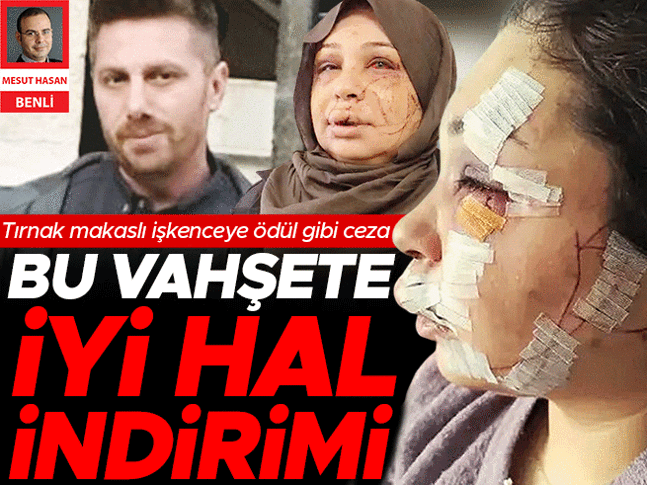 Eşe işkenceye ödül gibi ceza