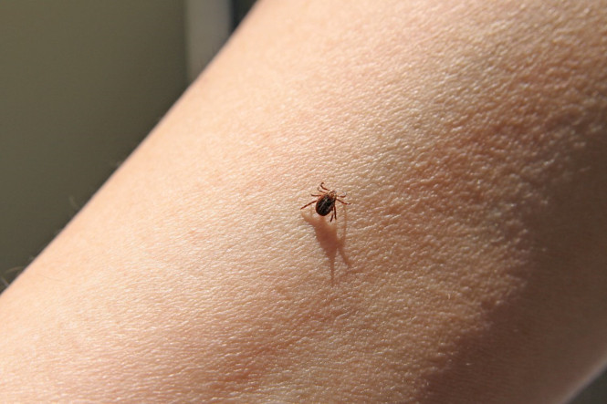 Lyme hastalığı nedir Belirtileri ve tedavi yöntemleri nelerdir