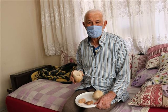 73 yaşındaki hastanın mesanesinden 2 kilo taş çıktı