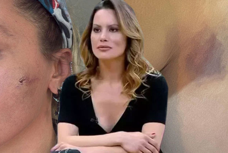 Yıldız Asyalı eşinden şiddet gördüğünü iddia etmişti... 'Korkuyorum'