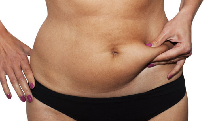 Polikistik over sendromu 5 hastalığı tetikleyebiliyor