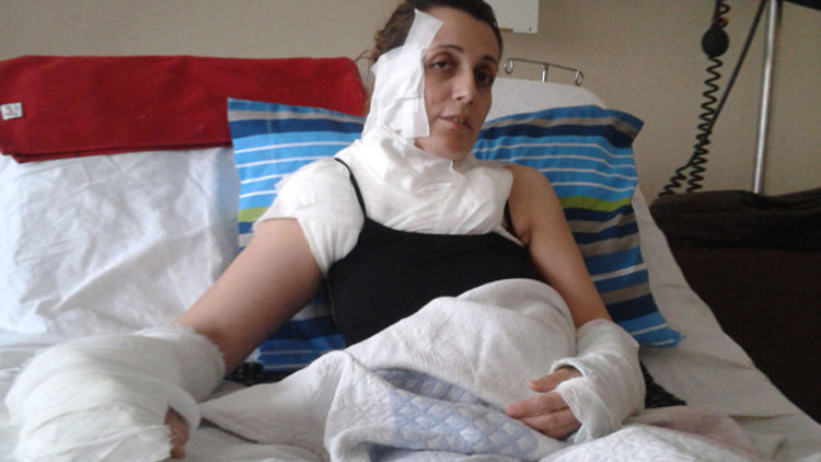 Lavabo açıcı vücudunu yaktı