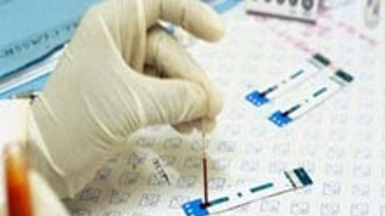 Kan testi ile Alzheimer teşhisi