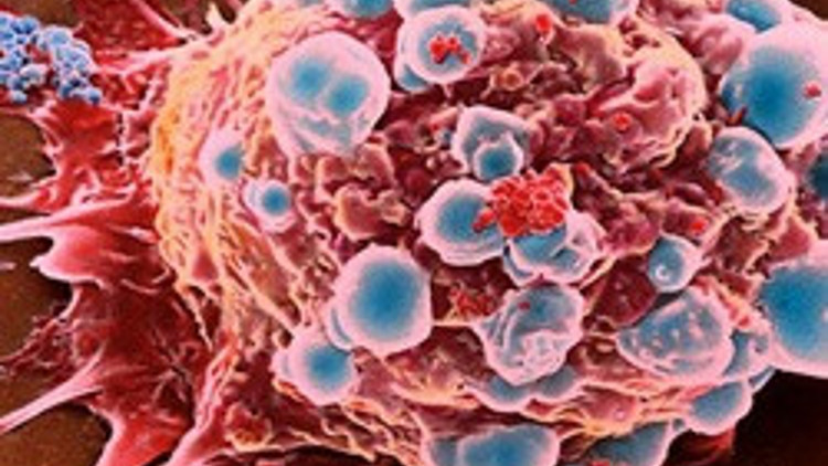 Kanserin doğum yerini buldular