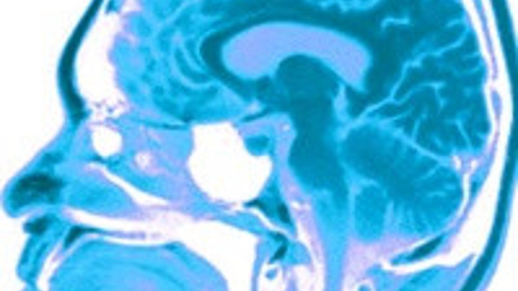 Dikkat eksikliğiniz var mı Dikkat eksikliğiniz var mı