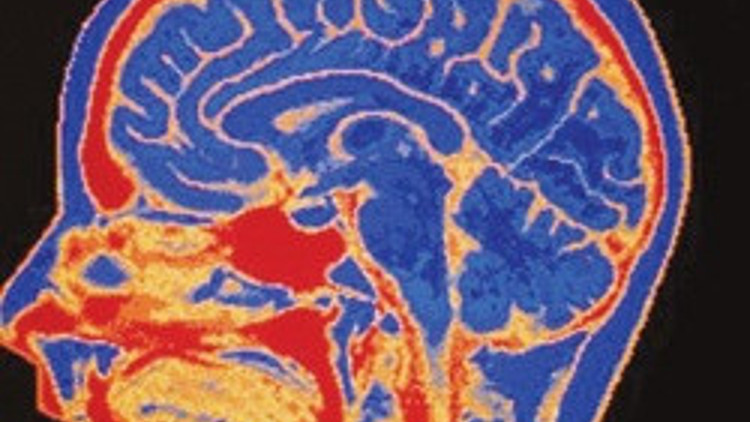 Kötü anıları silin gitsin