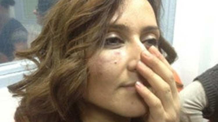 Fransada Azeri gençlere Hocalı saldırısı Fransada Azeri gençlere Hocalı saldırısı