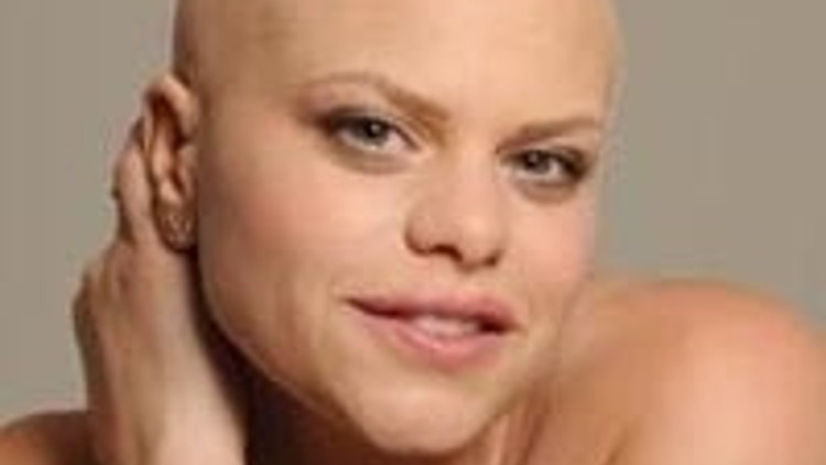 Dünyanın en ünlü kanser hastası Jade Goody öldü Dünyanın en ünlü kanser hastası Jade Goody öldü