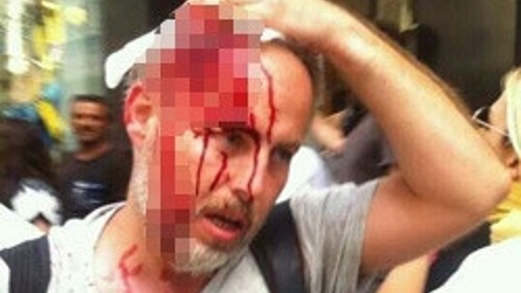 O fotoğrafı çeken Reuters muhabiri de yaralandı