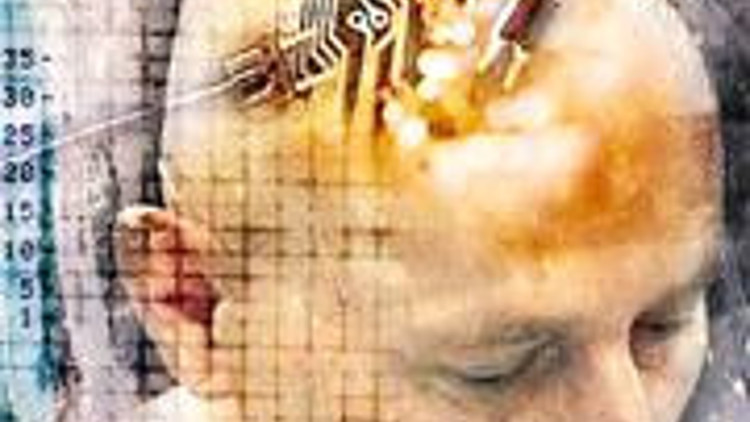 Felçli hastanın beynine ilk elektronik çip