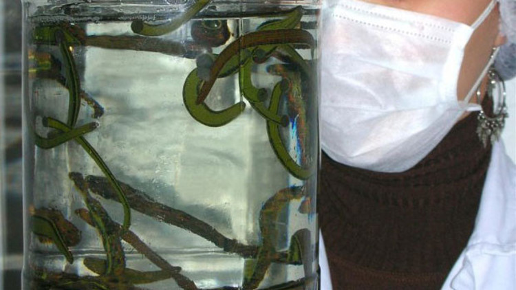 Sağlık Bakanlığından sülük tedavisine vize Sağlık Bakanlığından sülük tedavisine vize