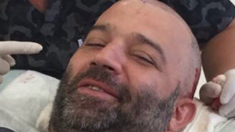 Şevket Çoruh saç ektirdi