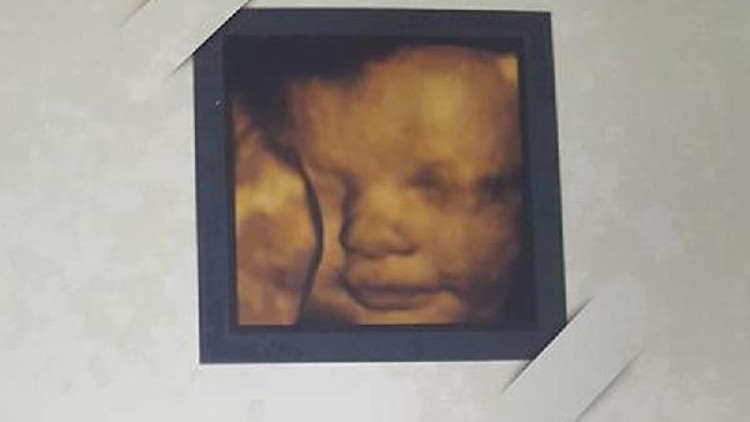 Doktorlar anne karnında bebek fotoğrafları ile yarışıyor