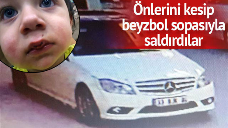 Şehir magandalarından beyzbol sopalı saldırı