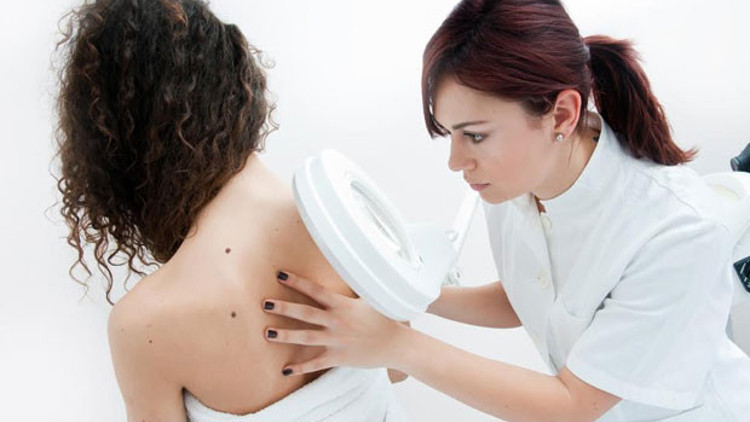 Saat başı 1 kişi melanomdan ölüyor