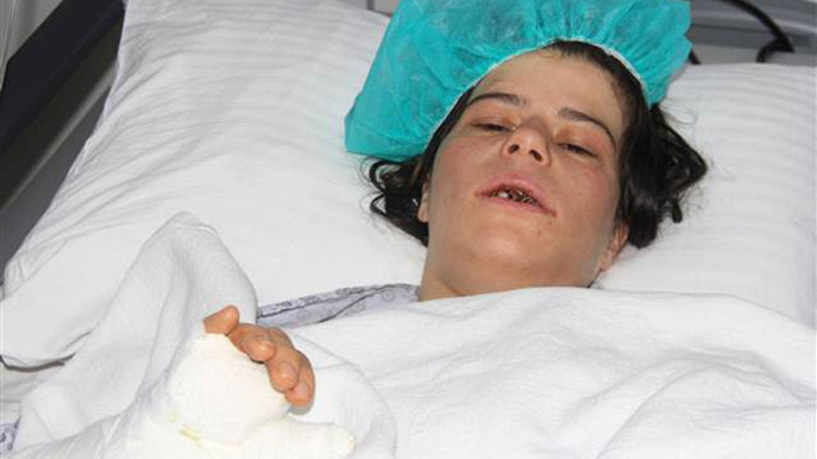 Korkunç Levyeyle dövüp, kerpetenle dişlerini söktü