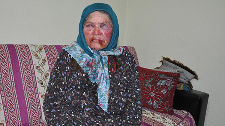 Bu hale getirip gasp etmişlerdi Gözaltına alınan kişi şoke etti Bu hale getirip gasp etmişlerdi Gözaltına alınan kişi şoke etti