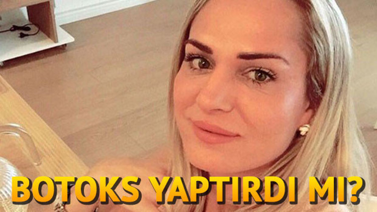 Nagihan Karadere kimdir Survivor Nagihan botoks mu yaptırdı