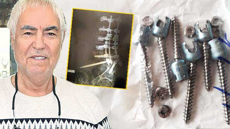 Bu çiviler benden çıktı Bu çiviler benden çıktı