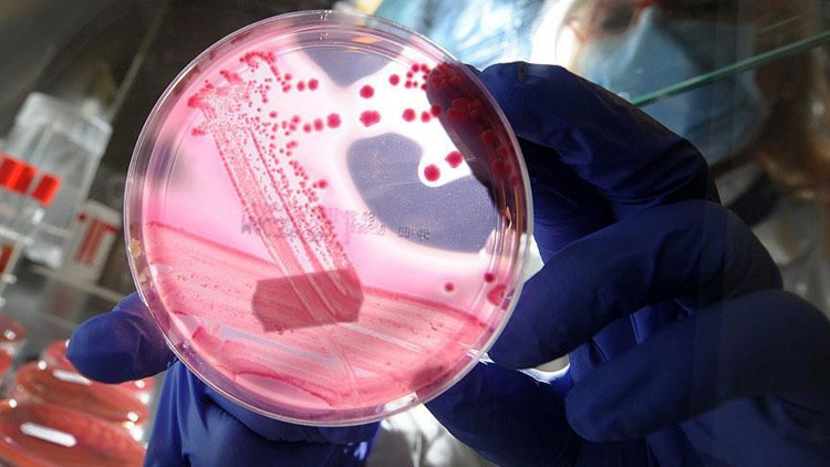 Pankreas nedir İşte pankreas kanseri hakkında bilgiler