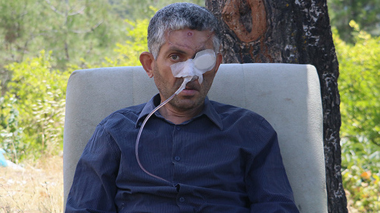Dişini çektirdikten sonra gözünü kaybettiği iddia edilmişti Hatay Valiliğinden açıklama geldi