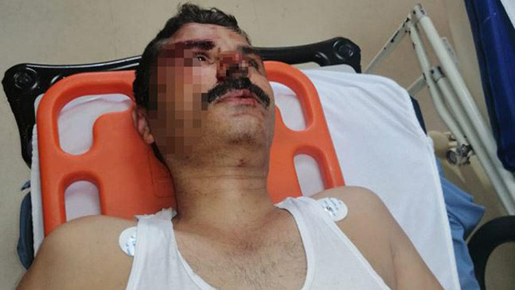 İzmitte sendikacıya muştalı saldırı