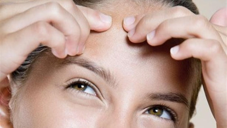 Fazla kilo sivilce yapar mı