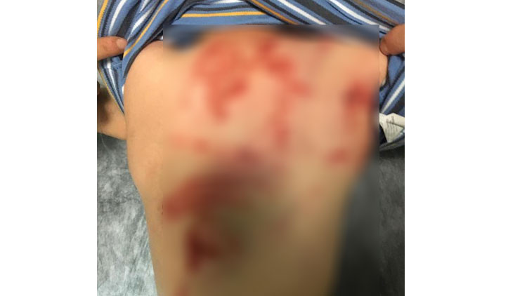 Her satırı iğrenç Küçük çocuk eve gelince ailesi fark etti