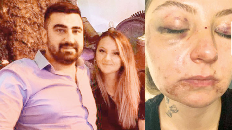 Dayakçı kocadan pişkin savunma: Isırığa rızası vardı Dayakçı kocadan pişkin savunma: Isırığa rızası vardı