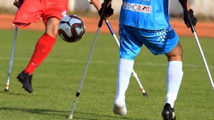 Ampute Ne Demek Ampute Nedir
