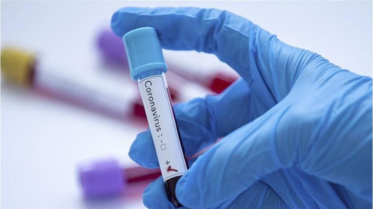 Buca cezaevinde bir tutuklunun covid-19 testi pozitif çıktı