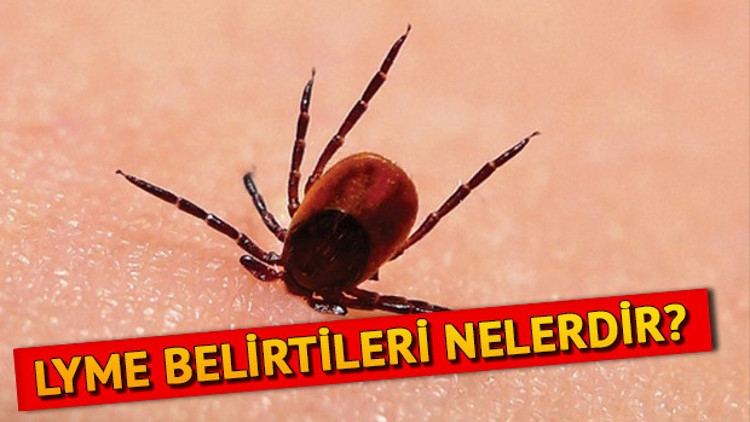 Lyme hastalığı nedir, belirtileri nelerdir Lyme hastalığı tedavisi var mı