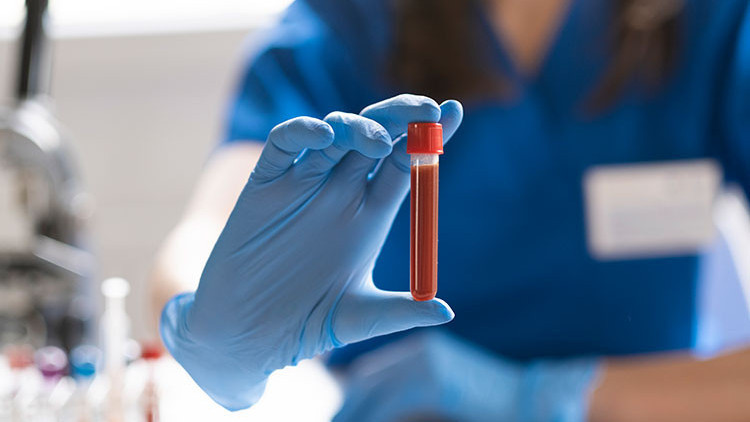 HGB nedir, değeri kaç olmalı HGB düşüklüğü ile yükseliği nedenleri ve belirtileri