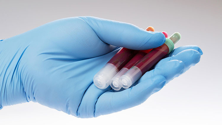 MVC nedir MVC değeri kaç olmalıdır Düşüklüğü ile yüksekliği nedenleri ve belirtileri MVC nedir MVC değeri kaç olmalıdır Düşüklüğü ile yüksekliği nedenleri ve belirtileri