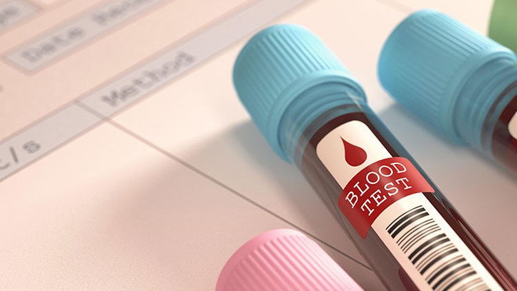 RDW, RDW-CV, RDW-SD nedir RDW değeri kaç olmalıdır Düşüklüğü ile yüksekliği nedenleri ve belirtileri