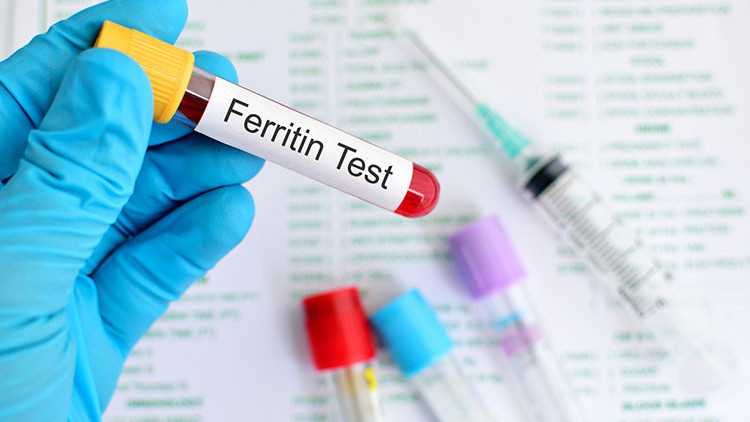 Ferritin nedir Ferritin değeri kaç olmalıdır Ferritin eksikliği ile yüksekliği nedenleri ve belirtileri