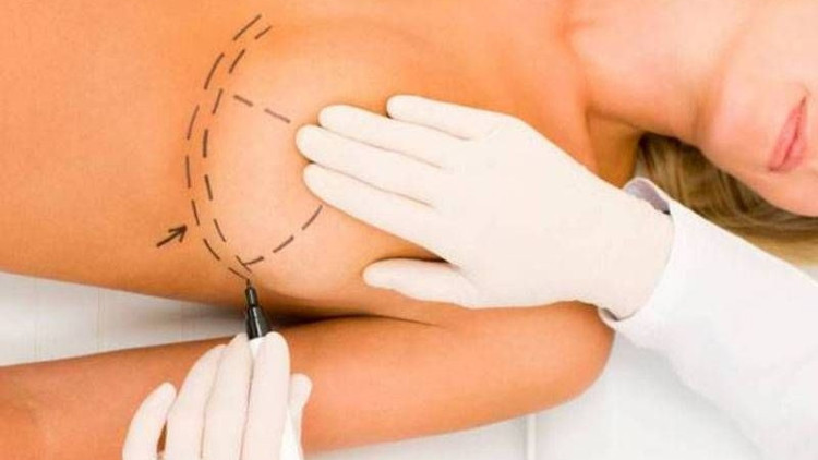 Doğum sonrası en çok bu estetikler talep görüyor Doğum sonrası en çok bu estetikler talep görüyor