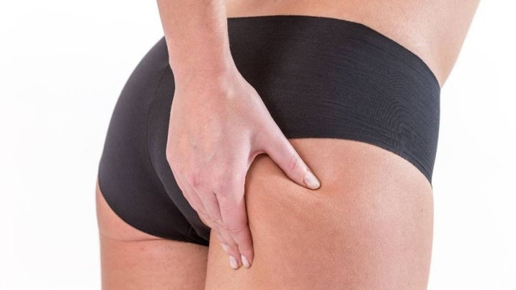 Antibiyotik tedavisi selülitlere çare olabilir mi