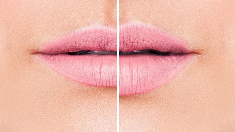 Dudaklarınız olmasa hayatınızda neler değişirdi Dudaklarınız olmasa hayatınızda neler değişirdi