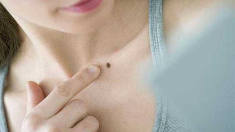 Ciltteki ben sayısı 50’yi geçiyorsa dikkat