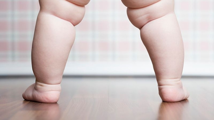 Raşitizm nedir Raşitizm nedenleri, belirtileri, tedavisi