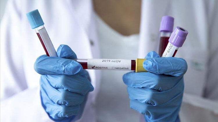 SON DAKİKA HABERİ: Corona virüsü (koronavirüs) ilgili dünyayı sarsacak iddia SON DAKİKA HABERİ: Corona virüsü (koronavirüs) ilgili dünyayı sarsacak iddia