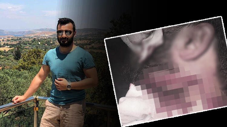 Son dakika... Doktor Kadir Songürü jiletle yaralamıştı 20 yıl hapis, indirim uygulanmadı