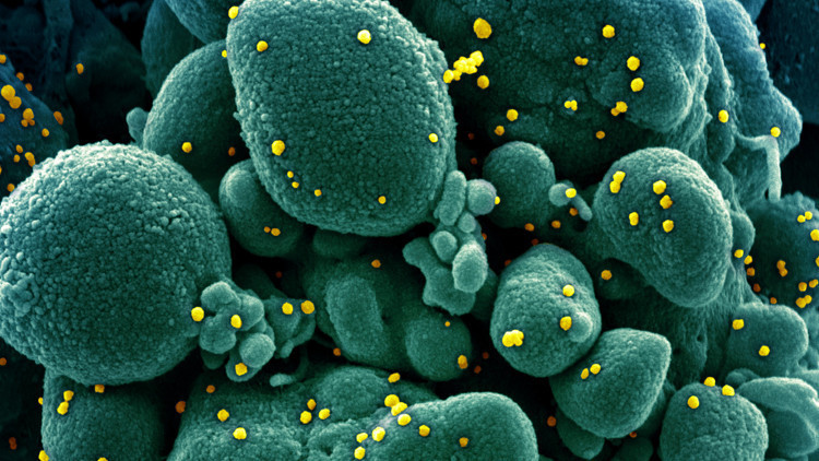 Uzmanlar aradaki farkı açıkladı İşte koronavirüsle karıştırılan hastalıklar… Uzmanlar aradaki farkı açıkladı İşte koronavirüsle karıştırılan hastalıklar…