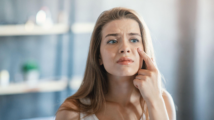 Sivilce oluşumuna karşı bunlara dikkat edin Sivilce oluşumuna karşı bunlara dikkat edin