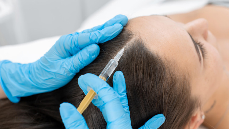 PRP Tedavisi ile Dökülen Saçlar Geri Kazanılır mı